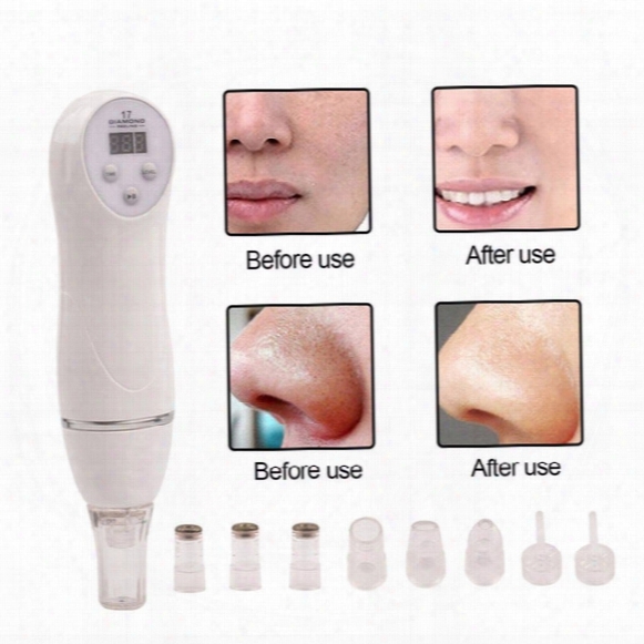 Tm-md004 Moq 1 110-220v Diamond Blackhead Vacuum Suction Remove Scars Acne Marks Face Beauty Device Dermabrasion Microdermabrasion Home Use